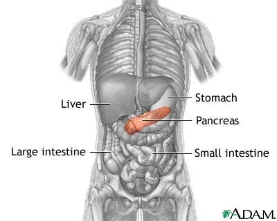 poza despre abces pancreatic